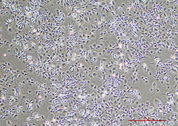 人肝癌细胞Hep-3B(STR鉴定) | EnkiLife恩玑生命