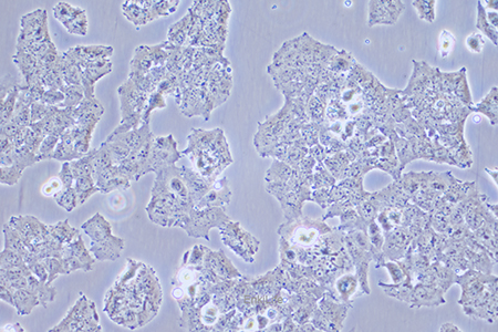 人肝癌细胞JHH-7(STR鉴定) | EnkiLife恩玑生命