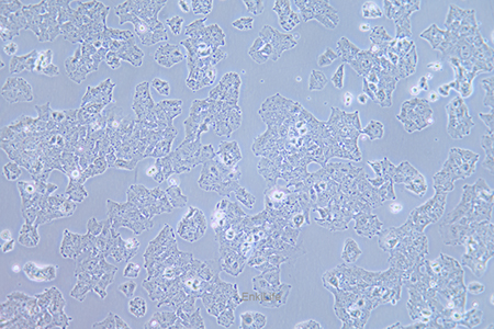 人肝癌细胞JHH-7(STR鉴定) | EnkiLife恩玑生命