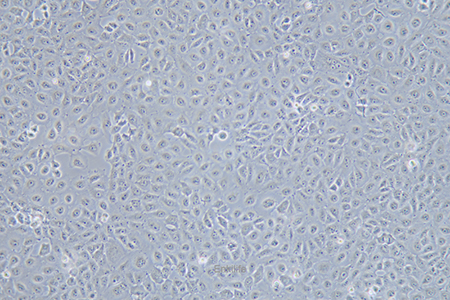 人肝癌细胞Mahlavu(STR鉴定) | EnkiLife恩玑生命