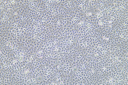 人肝癌细胞SMMC-7721(STR鉴定) | EnkiLife恩玑生命