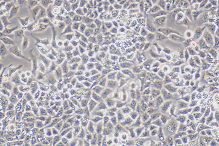 人肝癌细胞SMMC-7721(STR鉴定) | EnkiLife恩玑生命