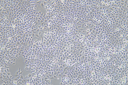 人肝癌细胞SMMC-7721(STR鉴定) | EnkiLife恩玑生命