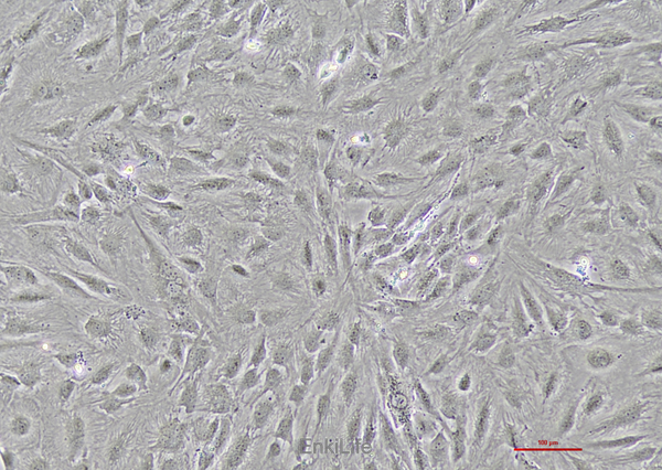 人肝癌细胞SNU-387(STR鉴定) | EnkiLife恩玑生命