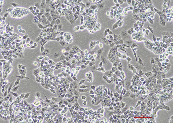 人肝癌细胞SNU-398(STR鉴定) | EnkiLife恩玑生命
