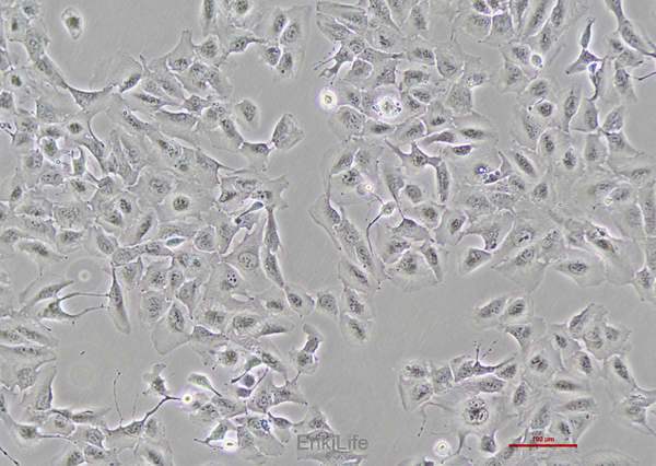 人肝胆管癌细胞RBE(STR鉴定) | EnkiLife恩玑生命