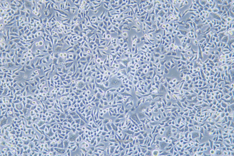 人高转移卵巢癌细胞	HO-8910PM(STR鉴定) | EnkiLife恩玑生命