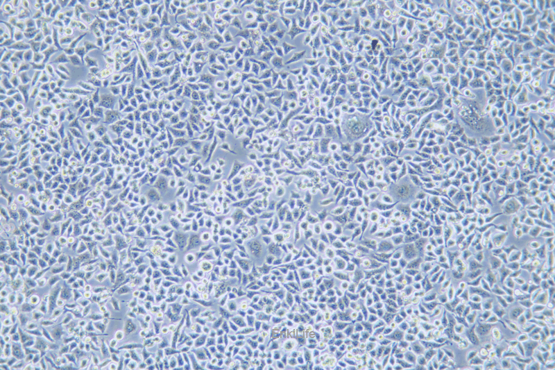 人高转移卵巢癌细胞	HO-8910PM(STR鉴定) | EnkiLife恩玑生命