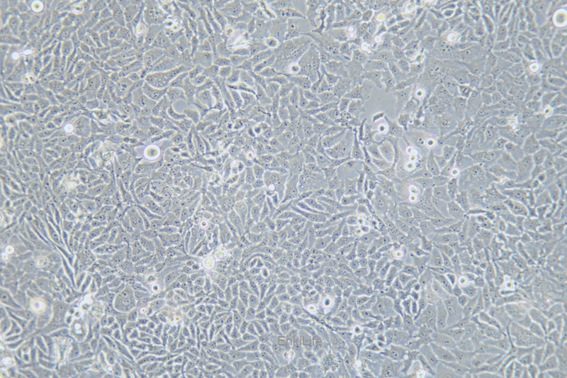 人宫颈癌细胞HELA.S3(STR鉴定) | EnkiLife恩玑生命