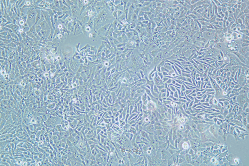 人宫颈癌细胞HELA.S3(STR鉴定) | EnkiLife恩玑生命