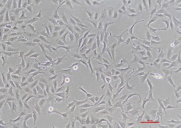 人骨肉瘤细胞HOS(STR鉴定) | EnkiLife恩玑生命