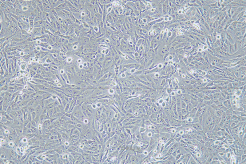 人骨肉瘤细胞KHOS-240S(STR鉴定) | EnkiLife恩玑生命