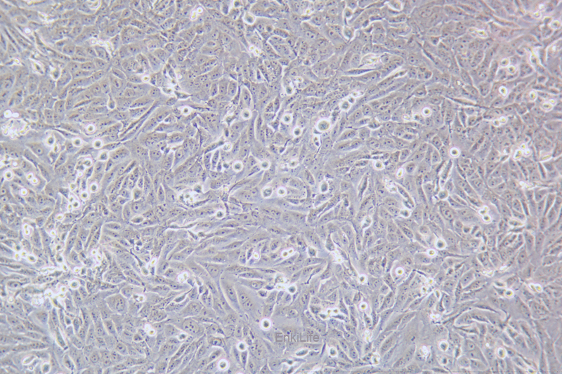 人骨肉瘤细胞KHOS-240S(STR鉴定) | EnkiLife恩玑生命