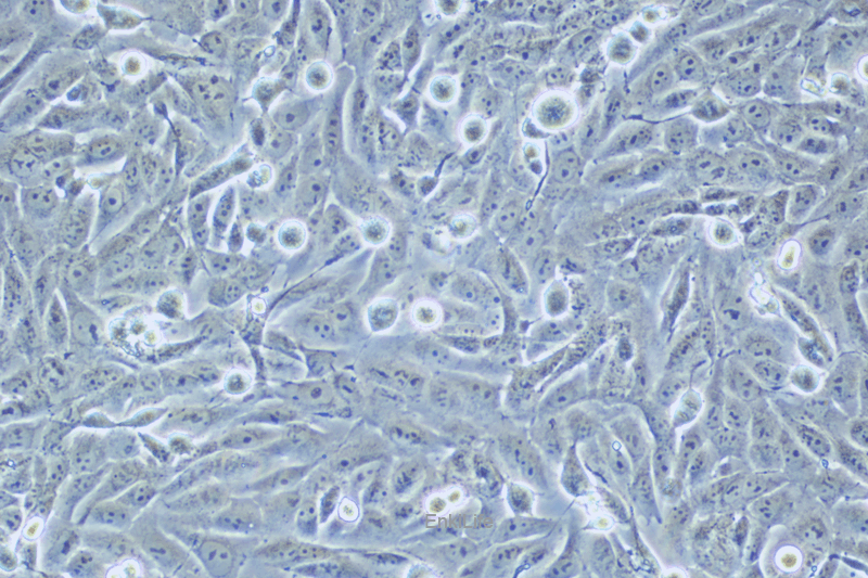 人骨肉瘤细胞KHOS-240S(STR鉴定) | EnkiLife恩玑生命