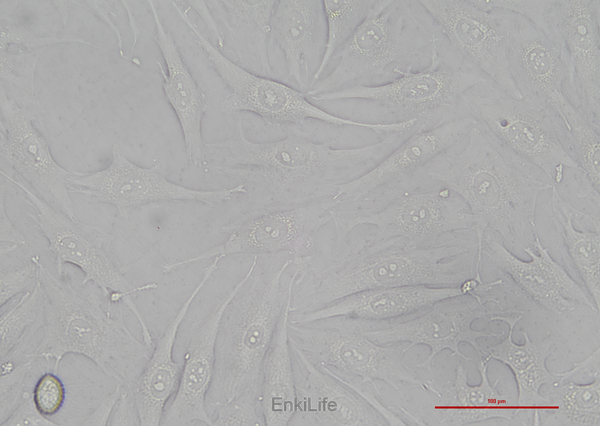 人骨肉瘤细胞MG-63(STR鉴定) | EnkiLife恩玑生命
