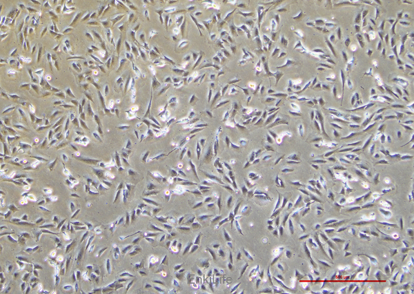 人骨肉瘤细胞SJSA-1(STR鉴定) | EnkiLife恩玑生命