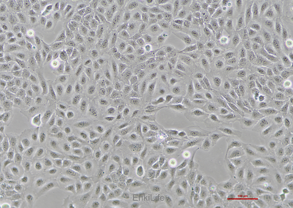 人骨肉瘤细胞U2OS(STR鉴定) | EnkiLife恩玑生命
