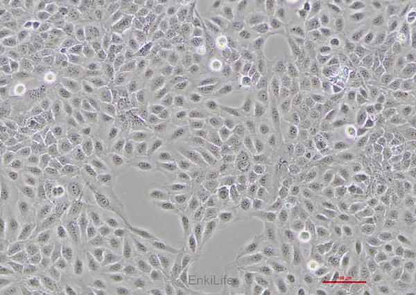 人骨肉瘤细胞U2OS(STR鉴定) | EnkiLife恩玑生命