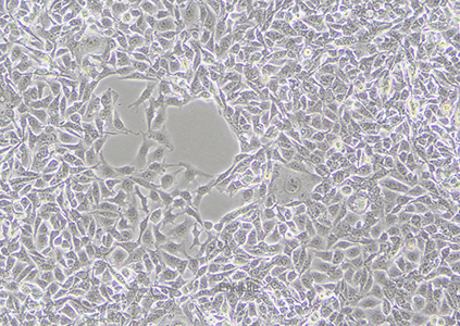 人黑色素瘤细胞MNT-1（STR鉴定） | EnkiLife恩玑生命