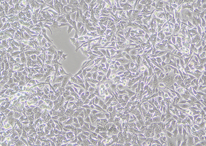 人黑色素瘤细胞MNT-1（STR鉴定） | EnkiLife恩玑生命