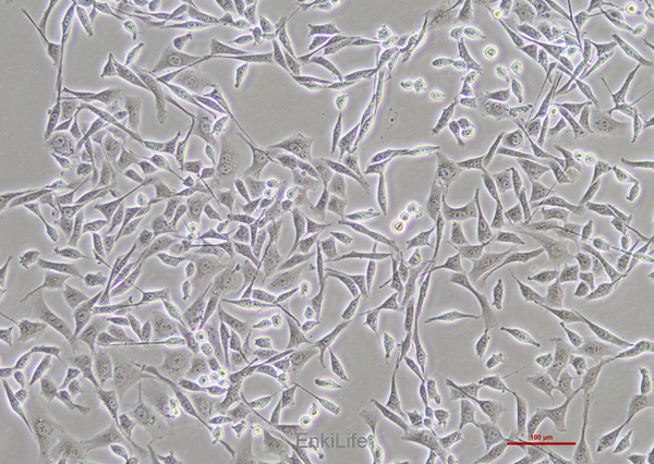 人横纹肌肉瘤细胞A-204 [A204](STR鉴定) | EnkiLife恩玑生命