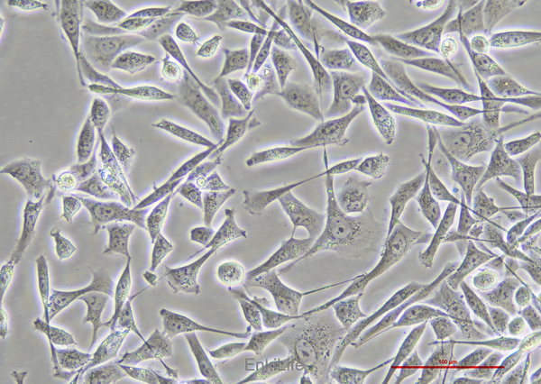 人横纹肌肉瘤细胞A-204 [A204](STR鉴定) | EnkiLife恩玑生命