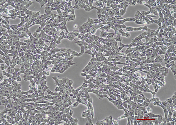 人横纹肌肉瘤细胞A-673(STR鉴定) | EnkiLife恩玑生命