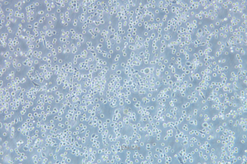人红白细胞白血病细胞HEL(STR鉴定) | EnkiLife恩玑生命