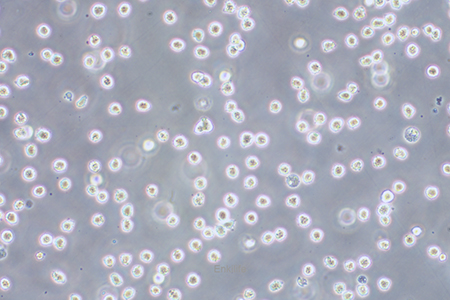 人红白血病细胞Kasumi-1(STR鉴定) | EnkiLife恩玑生命