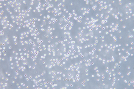 人红白血病细胞Kasumi-1(STR鉴定) | EnkiLife恩玑生命