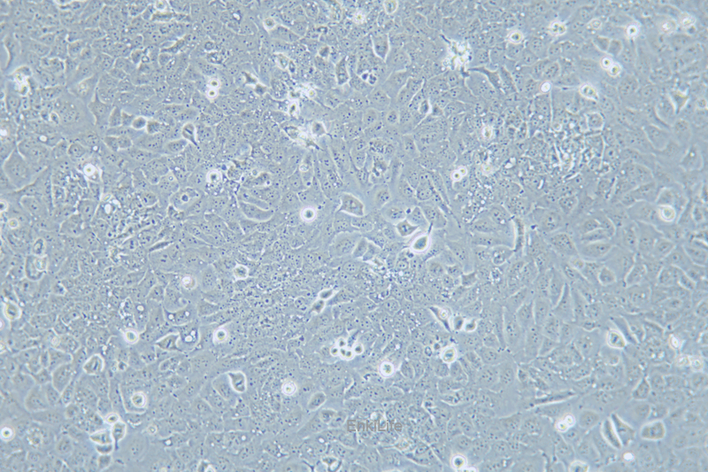 人喉癌细胞TU138(STR鉴定) | EnkiLife恩玑生命