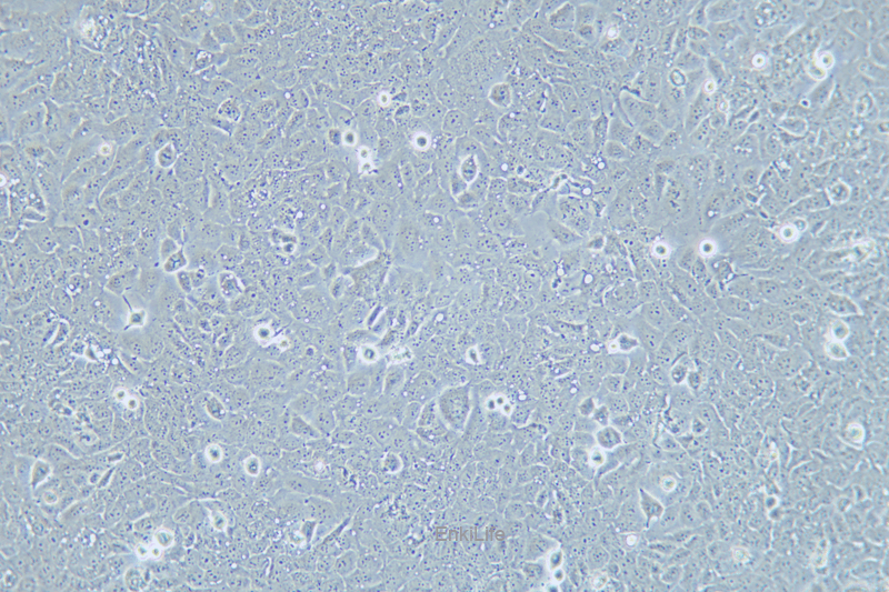 人喉癌细胞TU138(STR鉴定) | EnkiLife恩玑生命