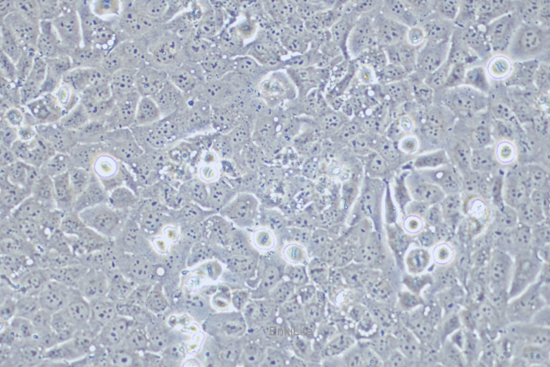 人喉癌细胞TU138(STR鉴定) | EnkiLife恩玑生命
