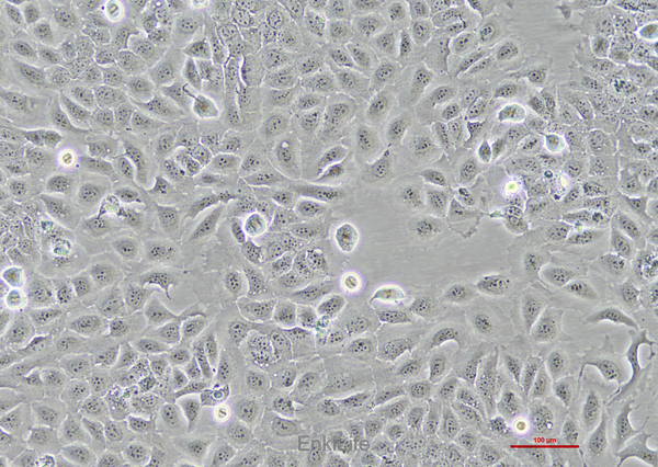 人喉癌细胞TU686 | EnkiLife恩玑生命