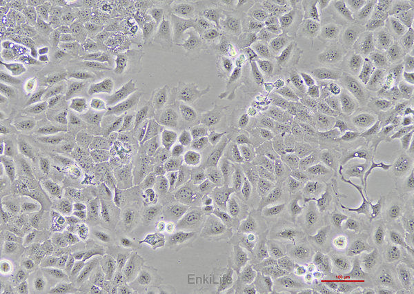 人喉癌细胞TU686 | EnkiLife恩玑生命