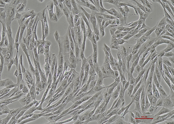 人滑膜肉瘤细胞SW982(STR鉴定) | EnkiLife恩玑生命