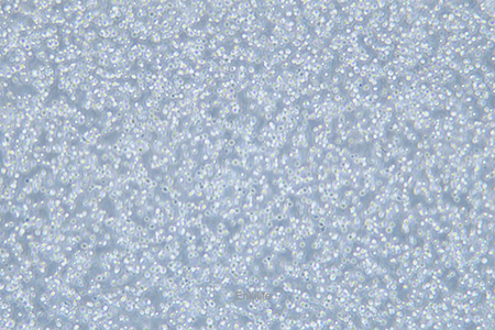 人急性淋巴细胞白血病细胞CCRF-CEM(STR鉴定) | EnkiLife恩玑生命