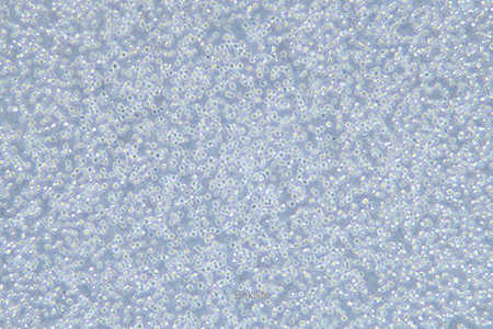 人急性淋巴细胞白血病细胞CCRF-CEM(STR鉴定) | EnkiLife恩玑生命