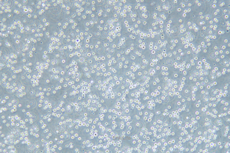 人急性淋巴细胞白血病细胞CEM/C1(STR鉴定) | EnkiLife恩玑生命