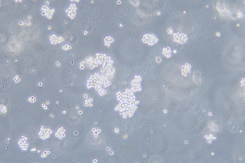 人急性髓系白血病细胞SKNO-1(STR鉴定) | EnkiLife恩玑生命