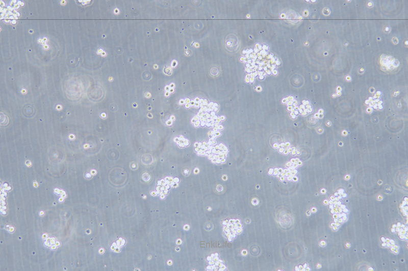 人急性髓系白血病细胞SKNO-1(STR鉴定) | EnkiLife恩玑生命