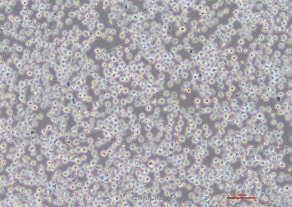 人急性髓细胞性白血病细胞OCI-AML3(STR鉴定) | EnkiLife恩玑生命