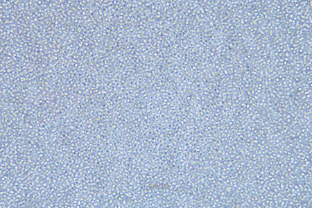 人急性髓性白血病细胞KG-1A(STR鉴定) | EnkiLife恩玑生命