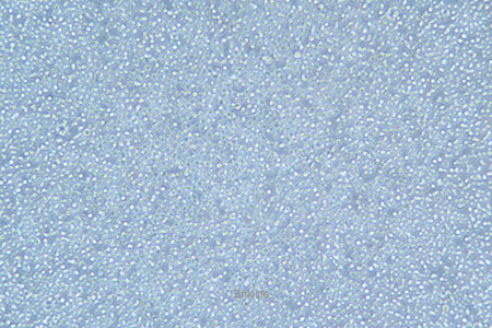 人急性髓性白血病细胞KG-1A(STR鉴定) | EnkiLife恩玑生命