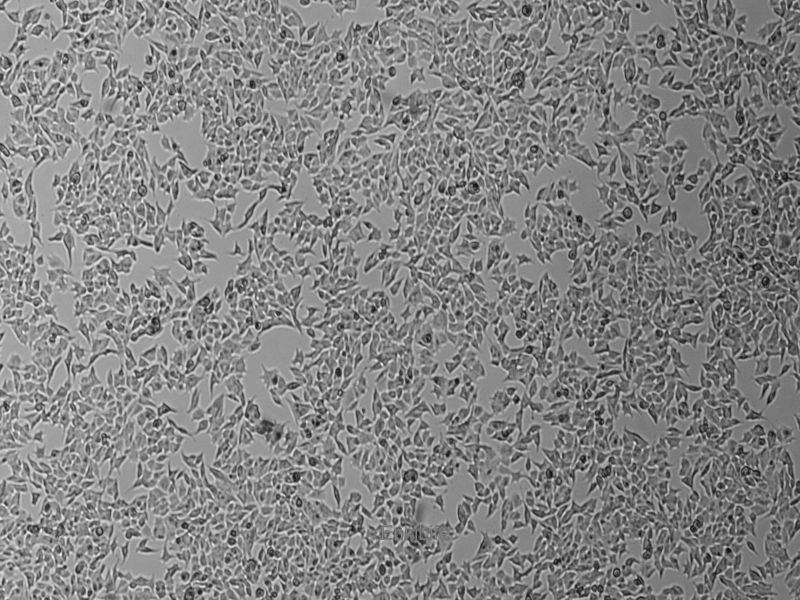 人甲状腺癌细胞TT(STR鉴定) | EnkiLife恩玑生命