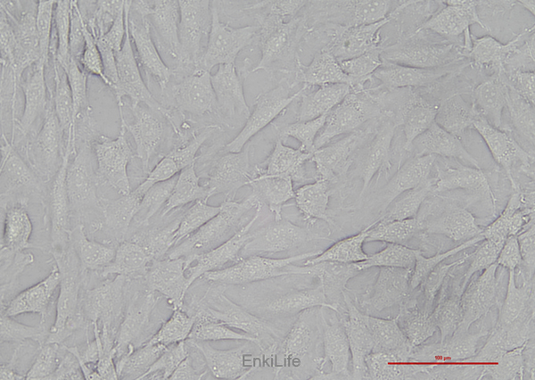人甲状腺鳞癌细胞SW579(STR鉴定) | EnkiLife恩玑生命