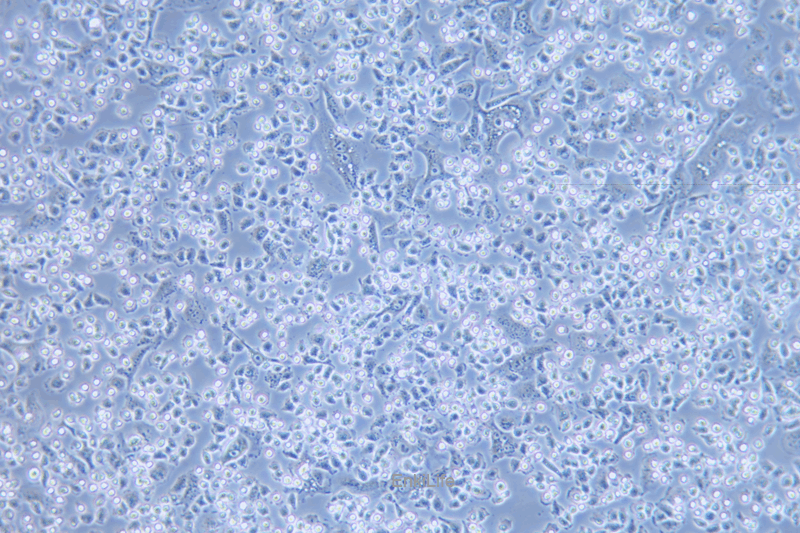 人甲状腺乳头状癌细胞IHH4(STR鉴定) | EnkiLife恩玑生命