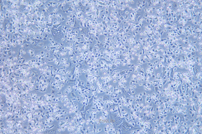 人甲状腺乳头状癌细胞IHH4(STR鉴定) | EnkiLife恩玑生命