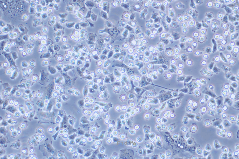 人甲状腺乳头状癌细胞IHH4(STR鉴定) | EnkiLife恩玑生命