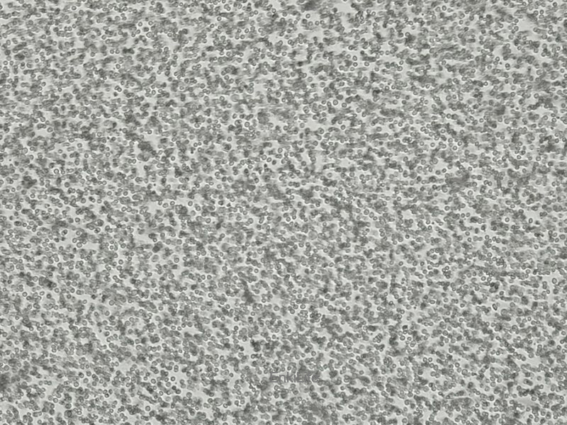 人间变性大细胞淋巴瘤细胞Karpas-299(STR鉴定) | EnkiLife恩玑生命